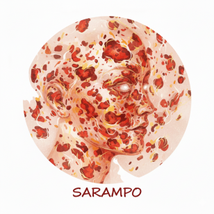 Sarampo