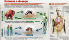 Sintomas e ciclo da FA