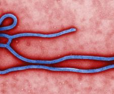 Vírus Ebola